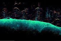 Echosonda LOWRANCE EYE 9 LIVE - 5